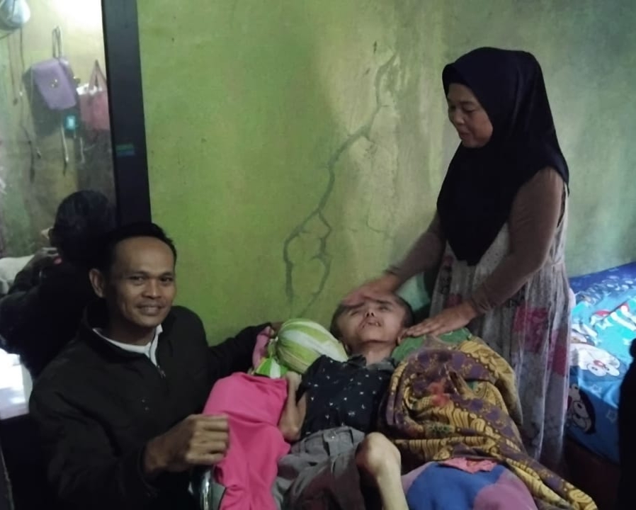 Pria di Sukabumi Idap Penyakit Hidrosefalus Sejak Lahir